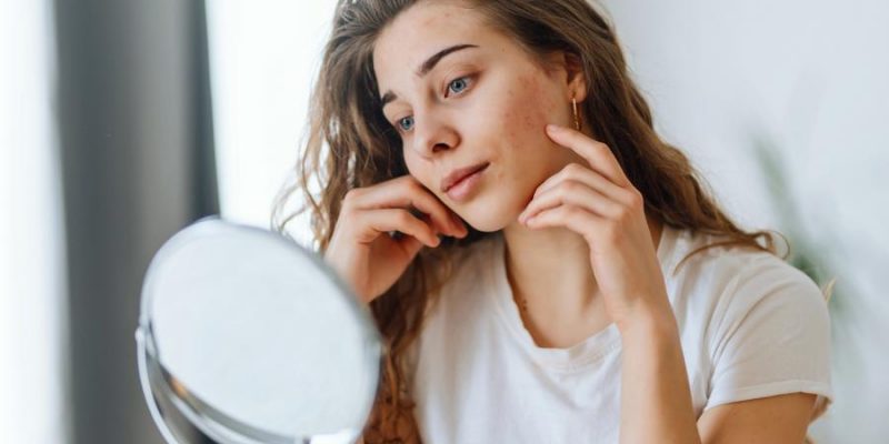 Allergien durch Kosmetik und Haarfärbemittel
